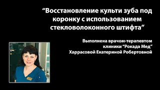 "Восстановление культи зуба под коронку с использованием стекловолоконного штифта"
